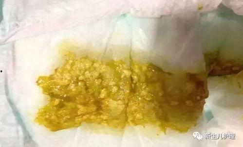 宝宝拉肚子可以以吃瓜洲,瓜洲美食助力宝宝拉肚子恢复之旅